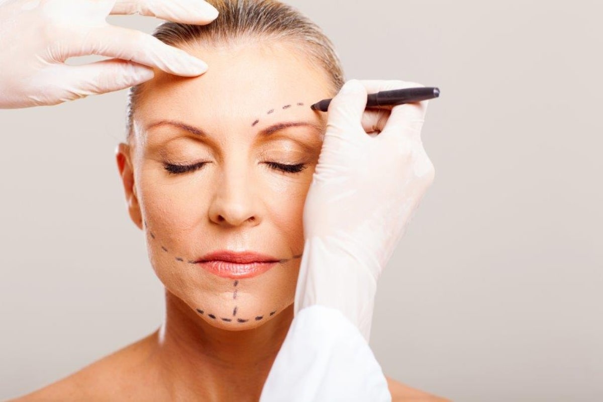 facelift-surgery-cost