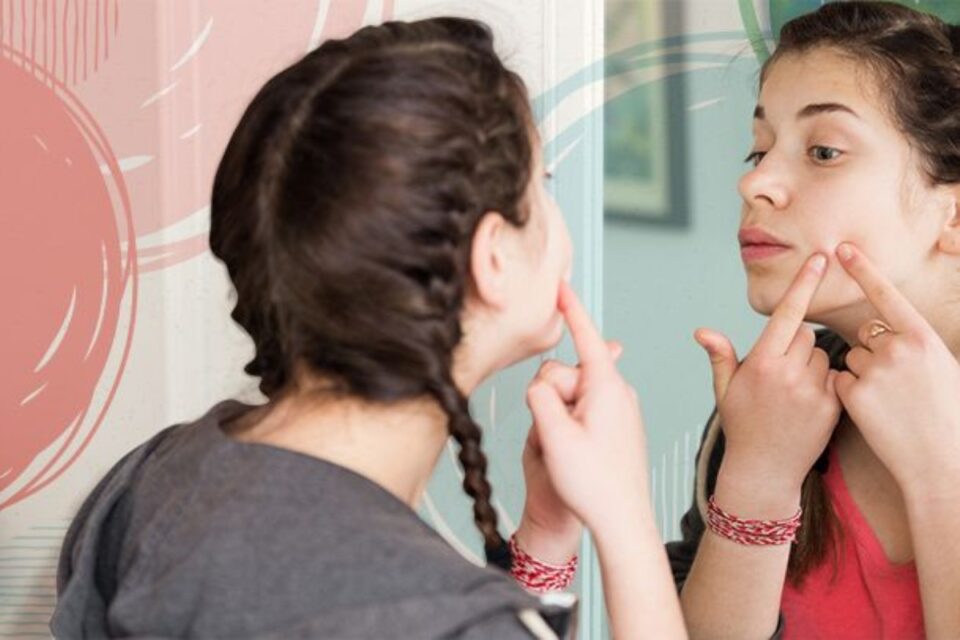 acne-treatment-for-teens